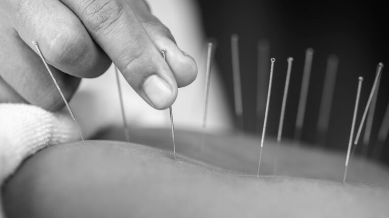 Effective Pain Management with Acupuncture in Bayside