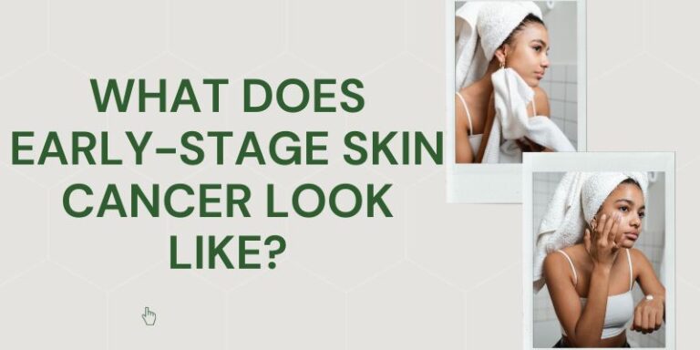 What Does Early-Stage Skin Cancer Look Like?